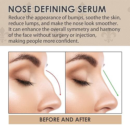 Nose Defining Serum: Lift, Shape, & Tighten (30ml)